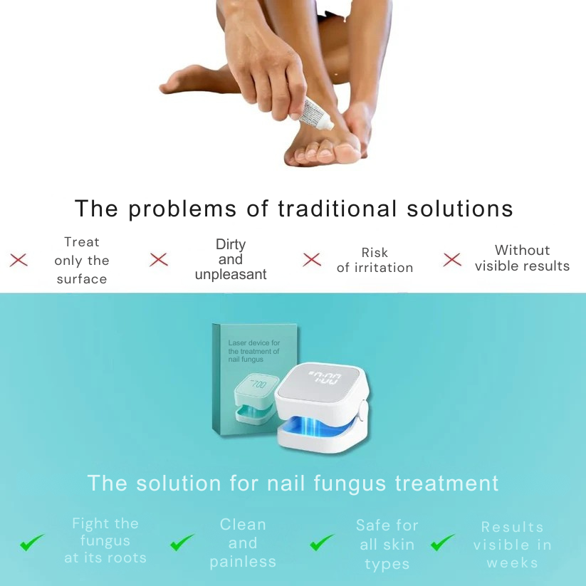The Ultimate Drug-Free Laser Solution Against Nail Fungus