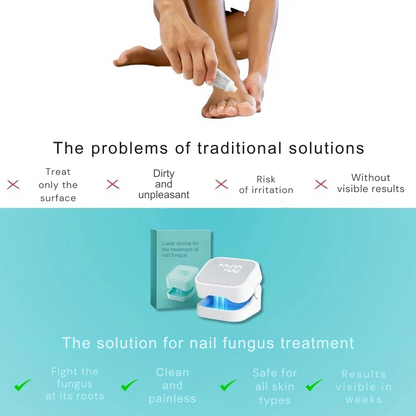 The Ultimate Drug-Free Laser Solution Against Nail Fungus